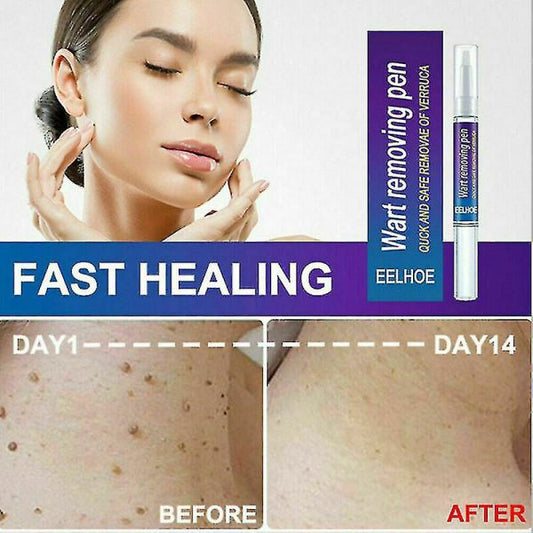 Warts Remover Original: Wart Removal Ointment Wart Treatment Skin Tag Mole Remover